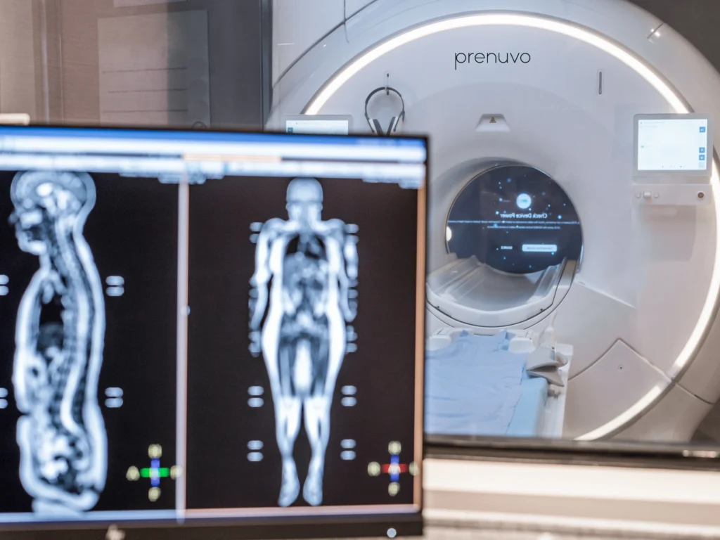 an image of Prenuvo MRI and findings