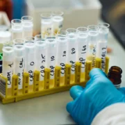lab testing, testing viles