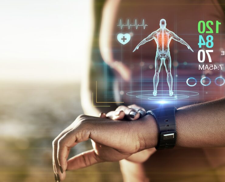 smartwatch technology
