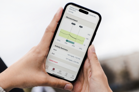 Dexcom app